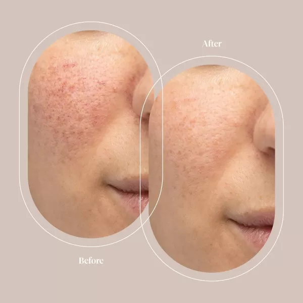 Trophy Skin Argan Stem Cell Serum  Topical AgeDefying Skin Hydrator with Hyaluronic Acid and Argan Oil to Soothe Nourish and Rejuvenate Face for Moisturized and Glowing Skin  30 mL1 Fl Oz Pack of 1
